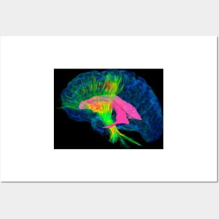 Brain fibres, DTI MRI scan (C017/7036) Posters and Art